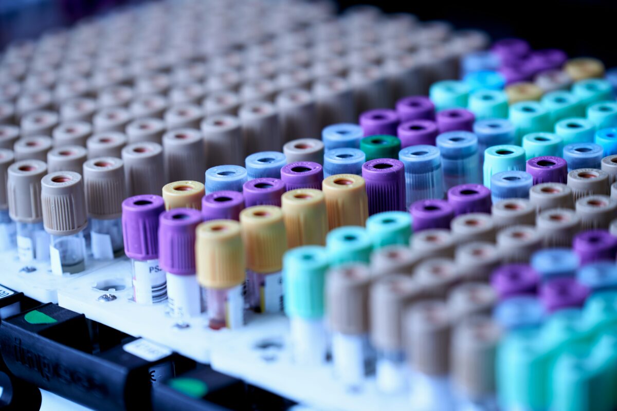 Bilan sanguin cholestérol : tubes de prélèvement en laboratoire