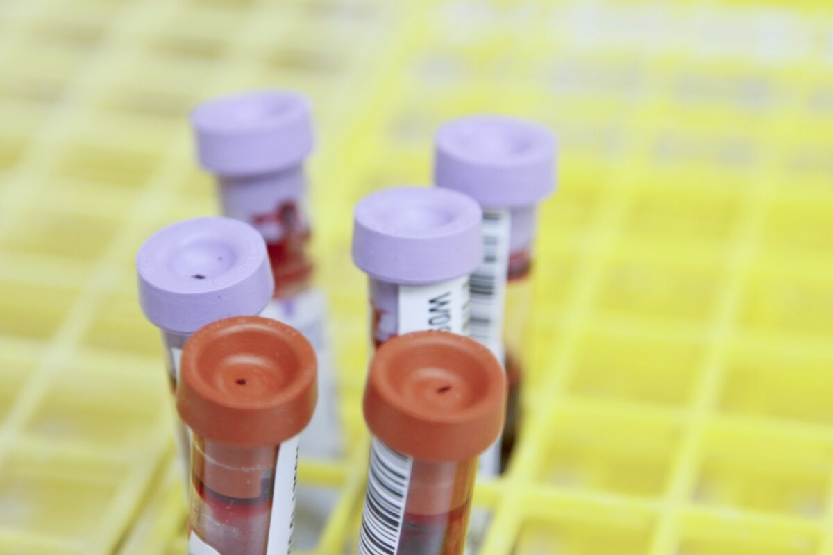 Tubes de prise de sang pour un dosage de ferritine élevée