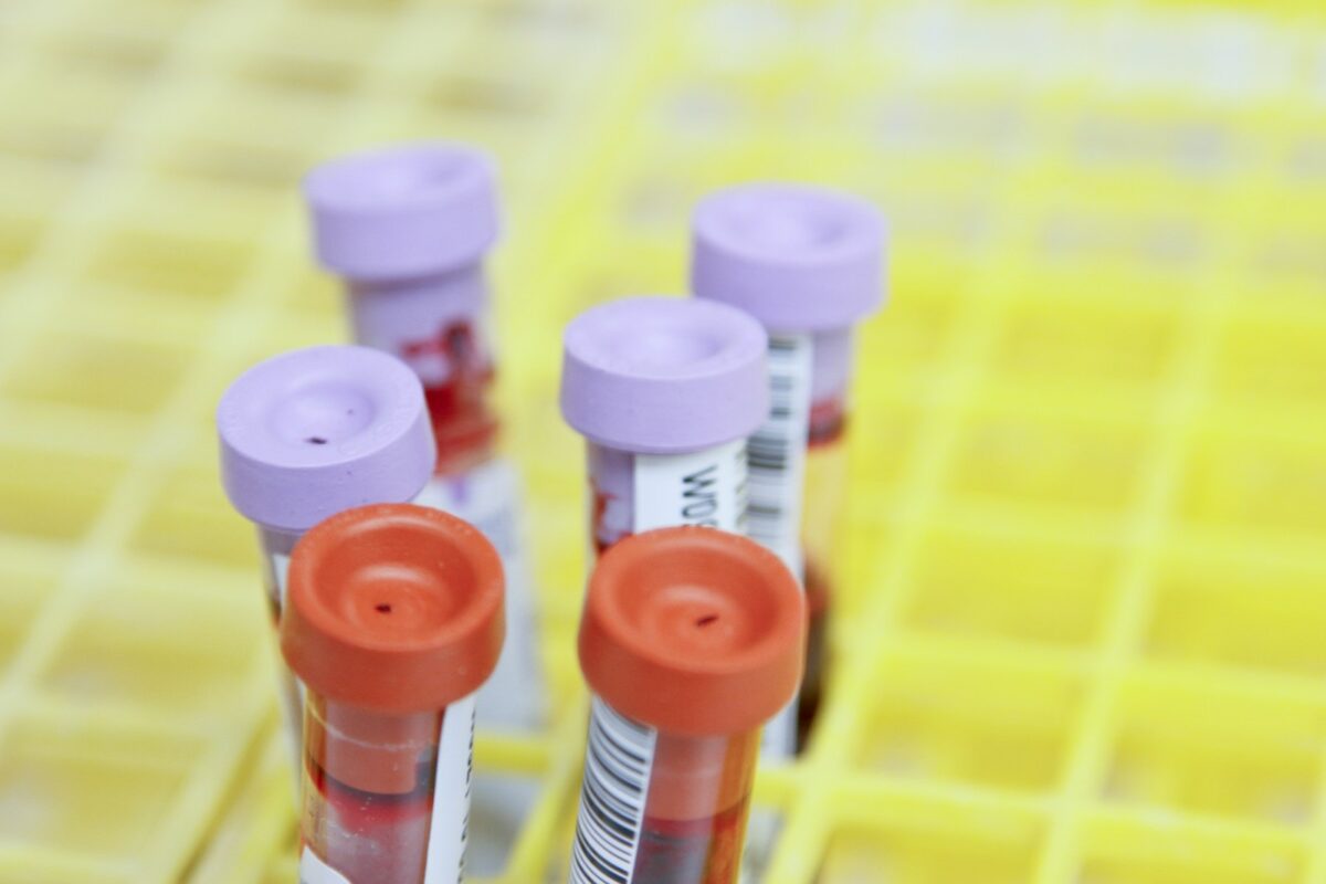 Tubes de prélèvement pour une prise de sang avec dosage de la protéine C-réactive