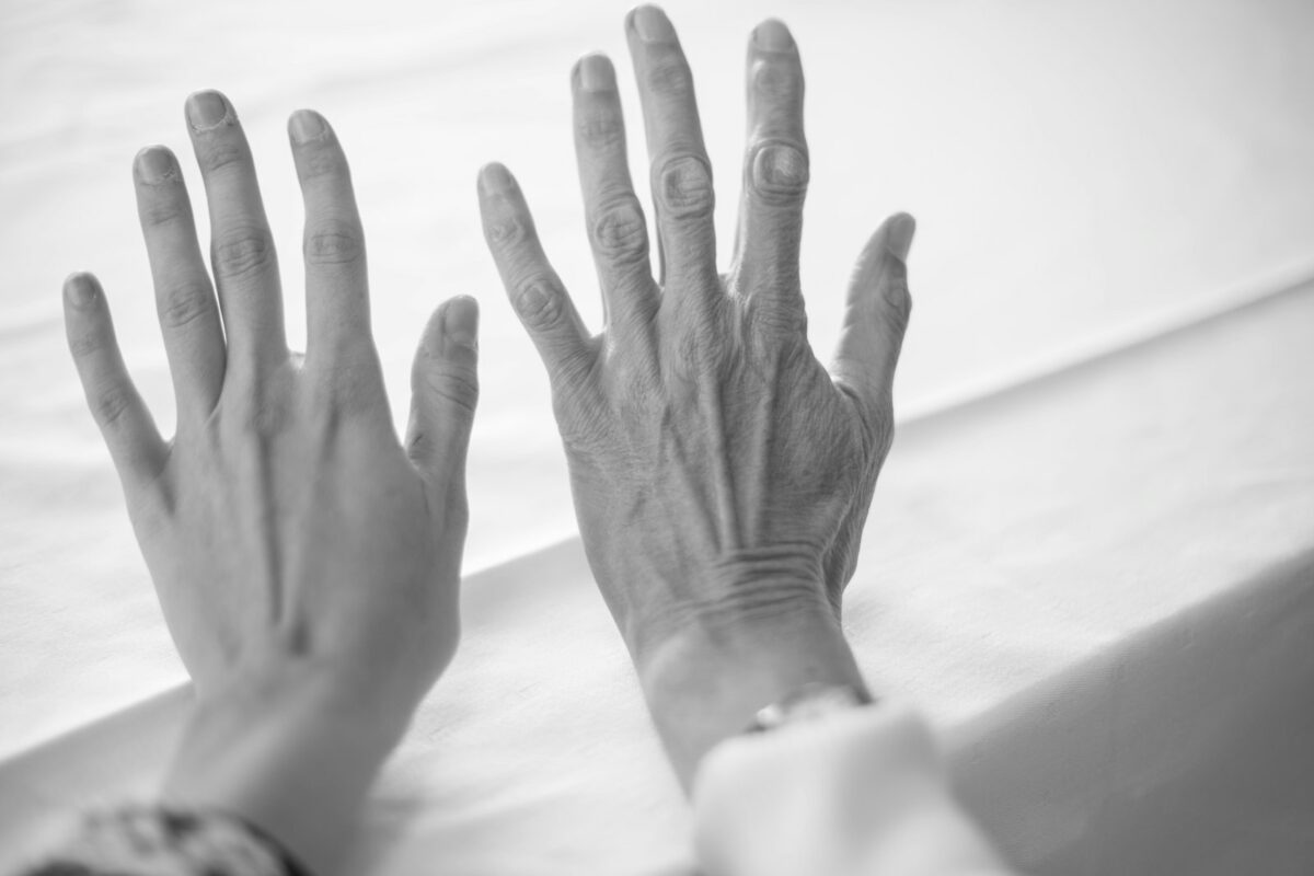 Taches brunes sur les mains : peau du dos des mains exposée au soleil